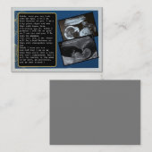 Carte De Référencement Faites la promotion de papa de Bump à papa : Père  (Devant / Derrière)