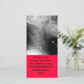 Carte De Remerciements le rayon X, choses a pu toujours être plus mauvais (Debout devant)