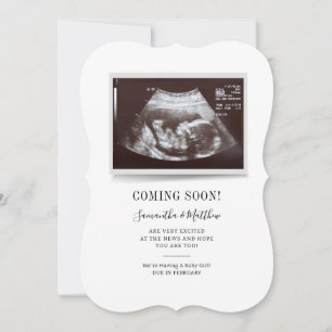 Carte de révélation du sexe du bébé par échographi
