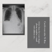 Carte De Visite ~ de rayon du coffre X potelé (Devant / Derrière)