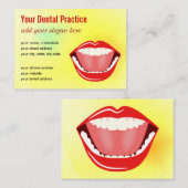 Carte De Visite Grosse Bouche Jaune Or Professionnel Dentelle (Devant / Derrière)