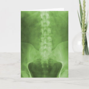 Carte de voeux verte d'art de rayon X de Digitals