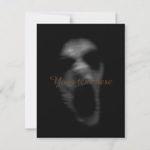 Carte Pertes de troubles mentaux