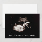 Carte photo d'échographie de la grossesse (Devant / Derrière)
