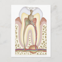 Abcès de pâte et racine