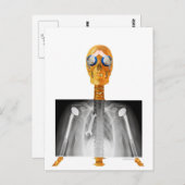 Carte postale adressée à Trump pour Trumpcare (Devant / Derrière)