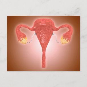 Carte Postale Anatomie De L'Utérus Féminin Avec Ovaires