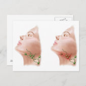 Carte Postale Anatomie Des Noeuds Lymphe Gonflés (Devant / Derrière)