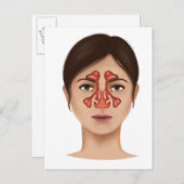 Carte Postale Anatomie Des Sinus Nasaux (Devant / Derrière)