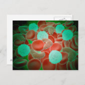 Carte Postale Anémie De Cellule De Faucille Avec Cellules De San (Devant / Derrière)