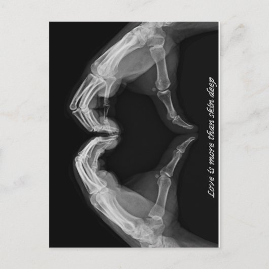 Carte Postale Art à rayons X (Devant)