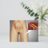 Carte Postale Artère étroite près de la jambe Gros plan (Debout devant)