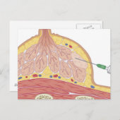 Carte Postale Aspiration fine des aiguilles (Devant / Derrière)