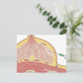 Carte Postale Aspiration fine des aiguilles (Debout devant)