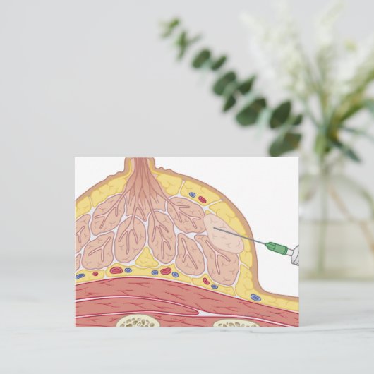 Carte Postale Aspiration fine des aiguilles (Debout devant)