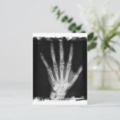 Carte Postale B&W X-ray Skeleton Main (Debout devant)