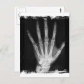 Carte Postale B&W X-ray Skeleton Main (Devant / Derrière)