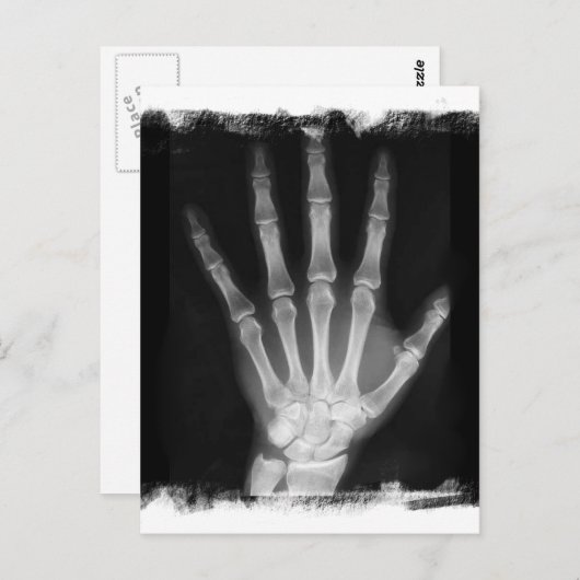 Carte Postale B&W X-ray Skeleton Main (Devant / Derrière)