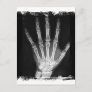 Carte Postale B&W X-ray Skeleton Main