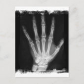 Carte Postale B&W X-ray Skeleton Main (Devant)