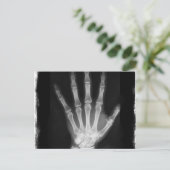 Carte Postale B&W X-ray Skeleton Main (Debout devant)