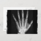 Carte Postale B&W X-ray Skeleton Main (Devant / Derrière)