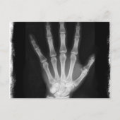 Carte Postale B&W X-ray Skeleton Main (Devant)