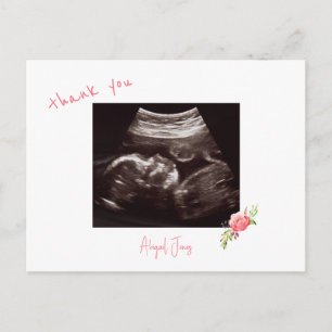Carte Postale Baby shower rose Ultrasound Cute Police Merci