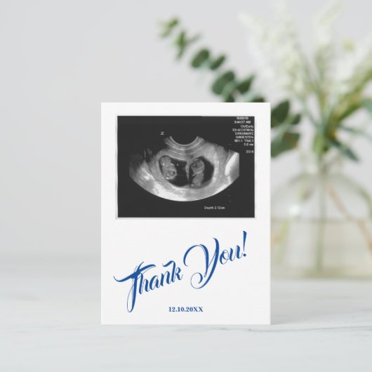 Carte Postale Baby shower Ultrasound Boy Merci bleu. (Debout devant)