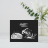 Carte Postale Bébé (Debout devant)
