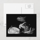 Carte Postale Bébé (Devant / Derrière)