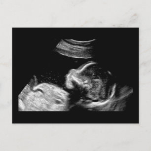 Carte Postale Bébé