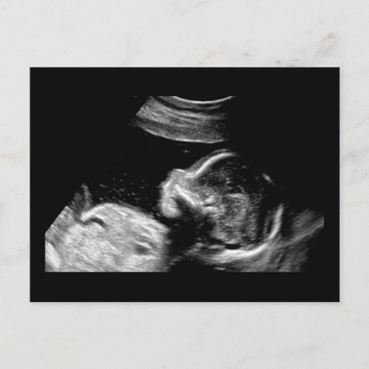 Carte Postale Bébé (Devant)