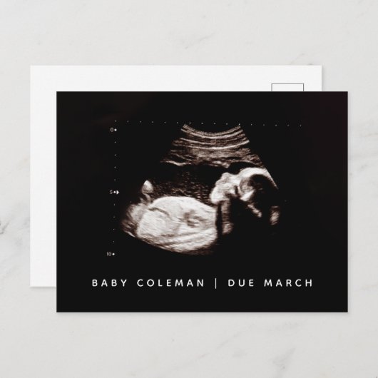 Carte Postale Bébé Sonogramme Grossesse Faire-part d'arrivée (Devant / Derrière)