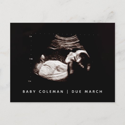 Carte Postale Bébé Sonogramme Grossesse Faire-part d'arrivée (Devant)
