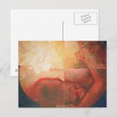 Carte Postale Blessure 2004 (Devant / Derrière)