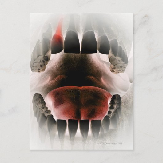 Carte Postale Bouche (Devant)