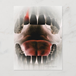 Carte Postale Bouche