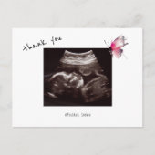 Carte Postale Cadeau Baby Shower Echographie Papillon Mignon Mer (Devant)