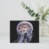 Carte Postale Cerveau X-Ray (Debout devant)
