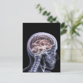 Carte Postale Cerveau X-Ray (Debout devant)