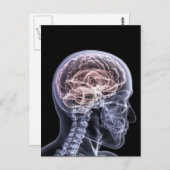 Carte Postale Cerveau X-Ray (Devant / Derrière)