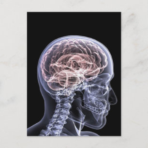 Carte Postale Cerveau X-Ray