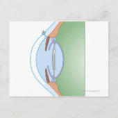 Carte Postale Chirurgie cataracte (Devant)