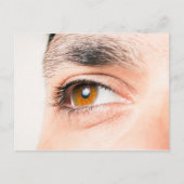 Carte Postale Closeuse oculaire humain (Devant)