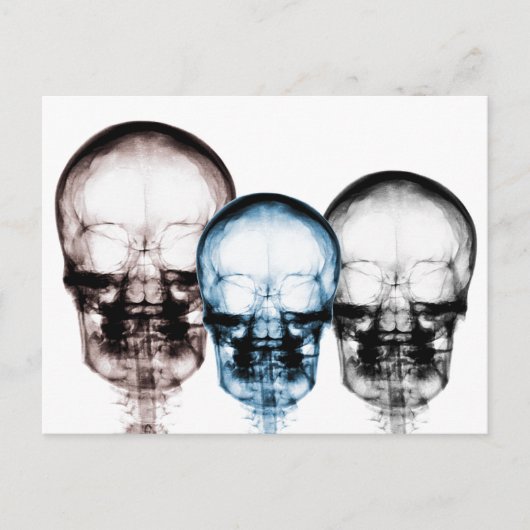 Carte Postale Couleurs mixtes X-Ray Vision Skeleton Skulls (Devant)