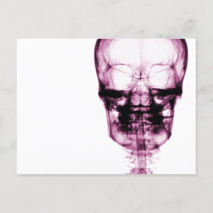 Carte Postale Crâne de vision à rayons X - rose