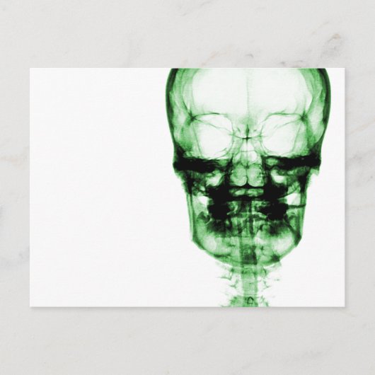 Carte Postale Crâne de vision à rayons X - Vert (Devant)