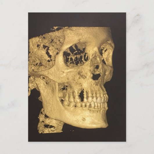 Carte Postale Crâne effrayant (Devant)