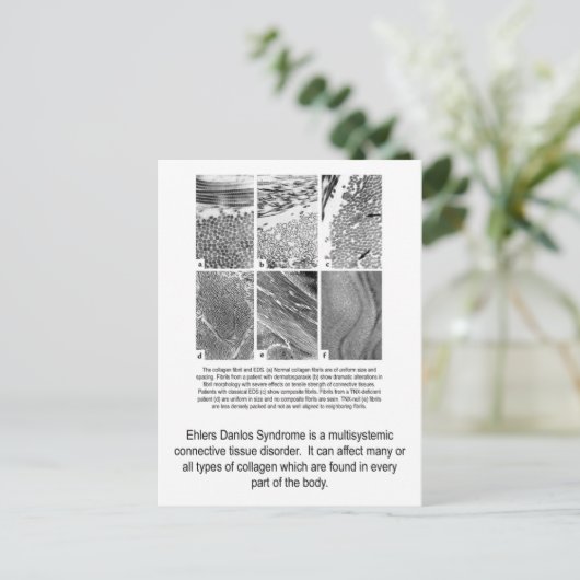 Carte postale défectueuse de conscience d'EDS de (Debout devant)